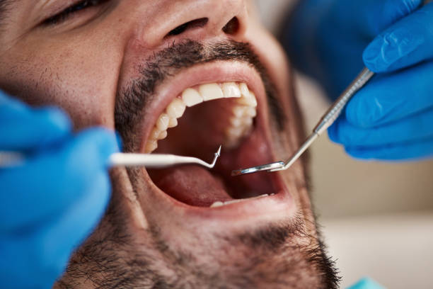 Best Emergency Treatment for Dental Infections or Abscesses in Four Corners, MT